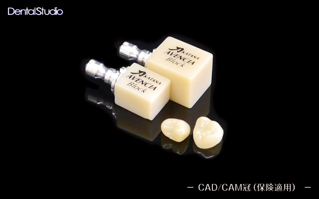 CAD/CAM冠（保険） | 取り扱い技工物 | 歯科技工のDSデンタルスタジオ