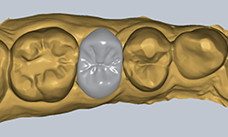 シングルクラウン2